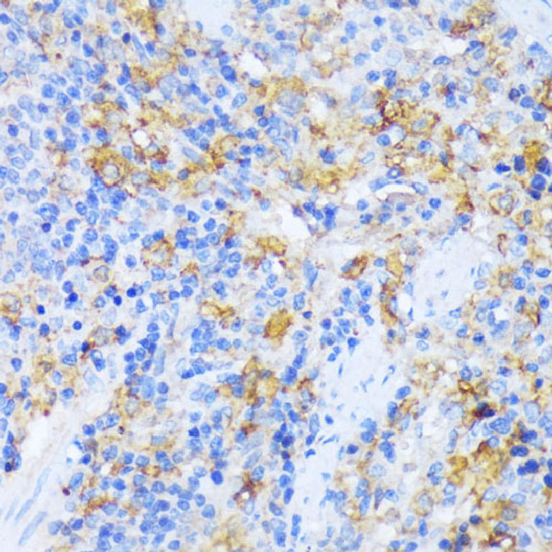 Immunohistochemistry - AARS antibody (A15017)