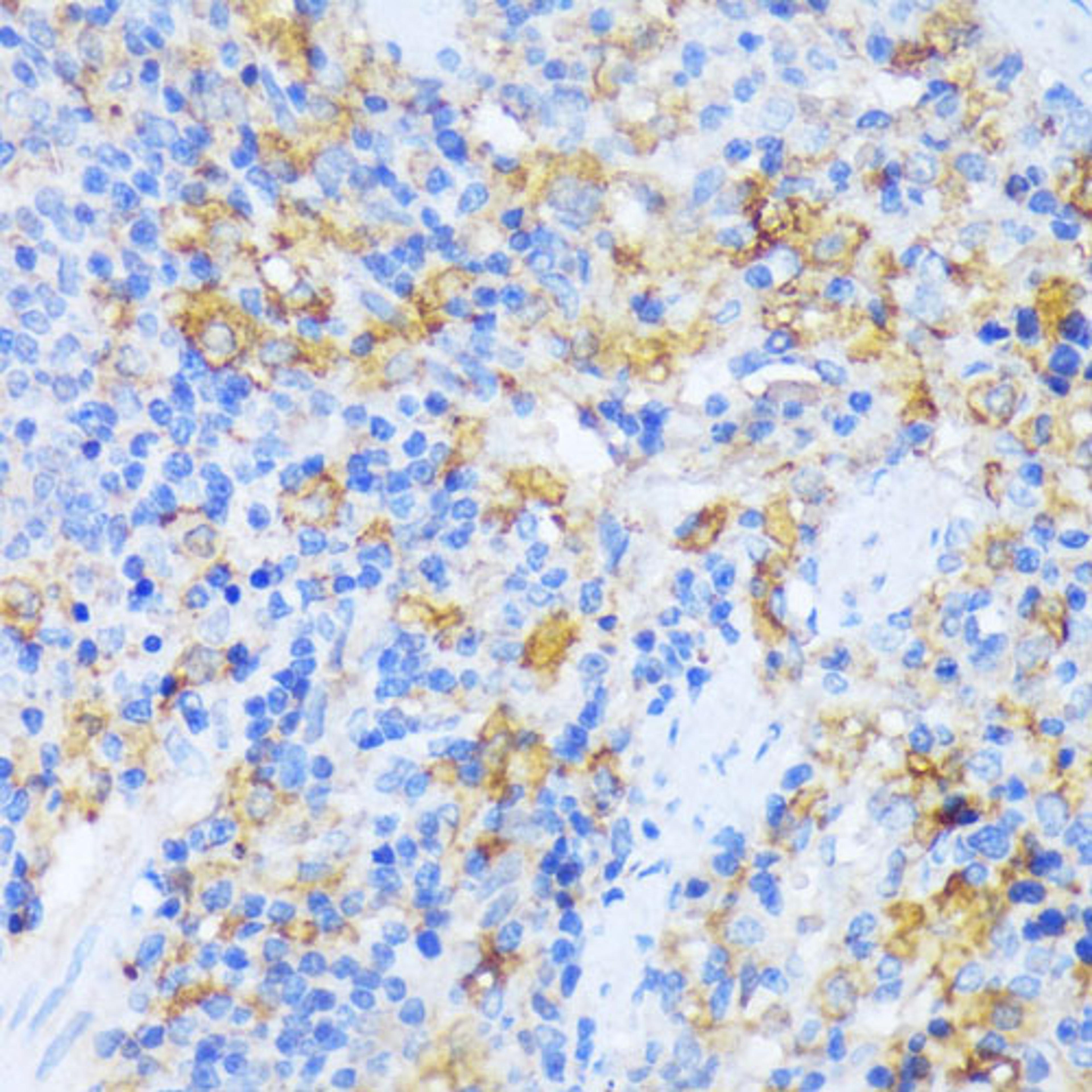 Immunohistochemistry - AARS antibody (A15017)