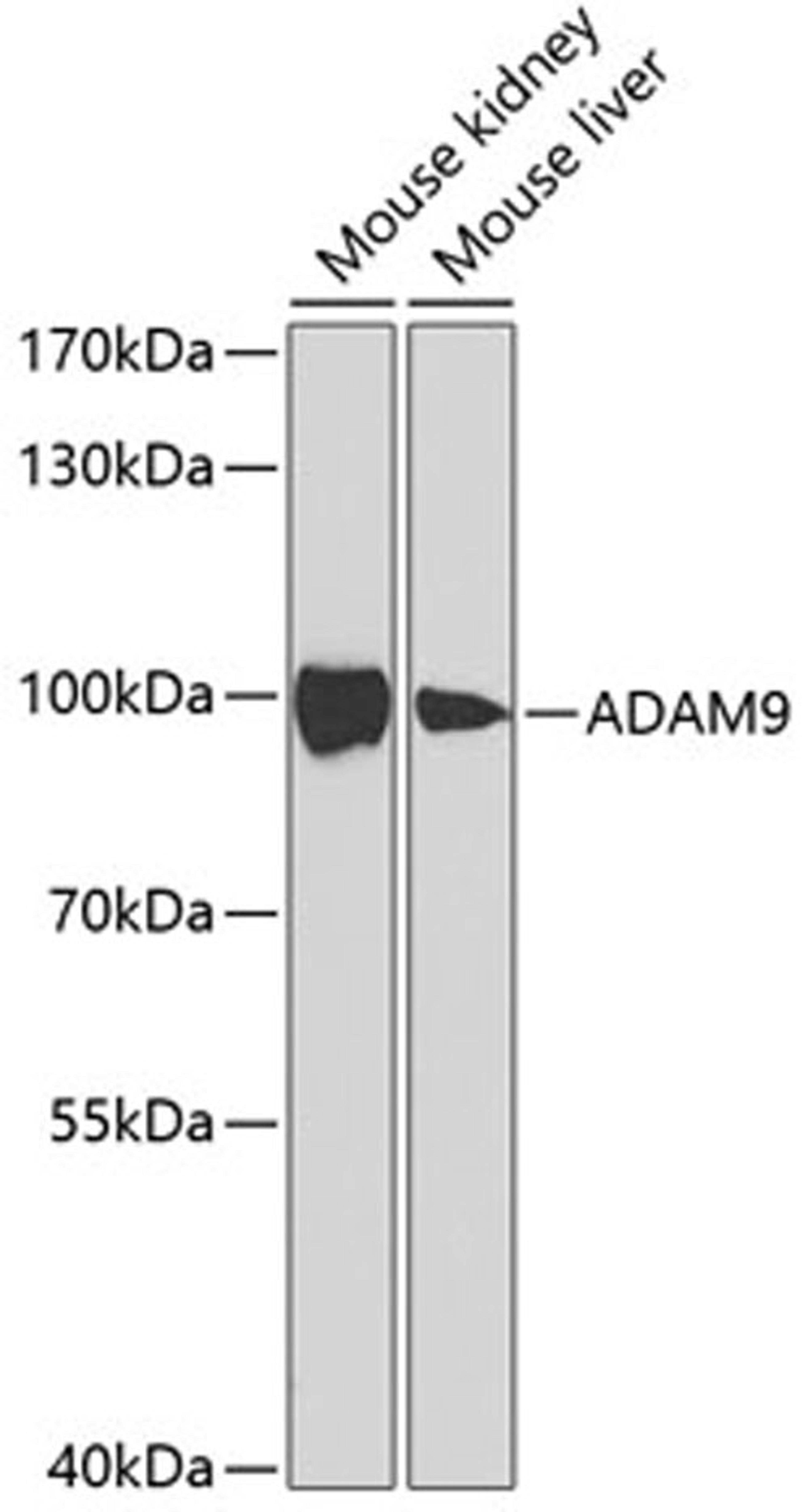 Western blot - ADAM9 antibody (A5388)