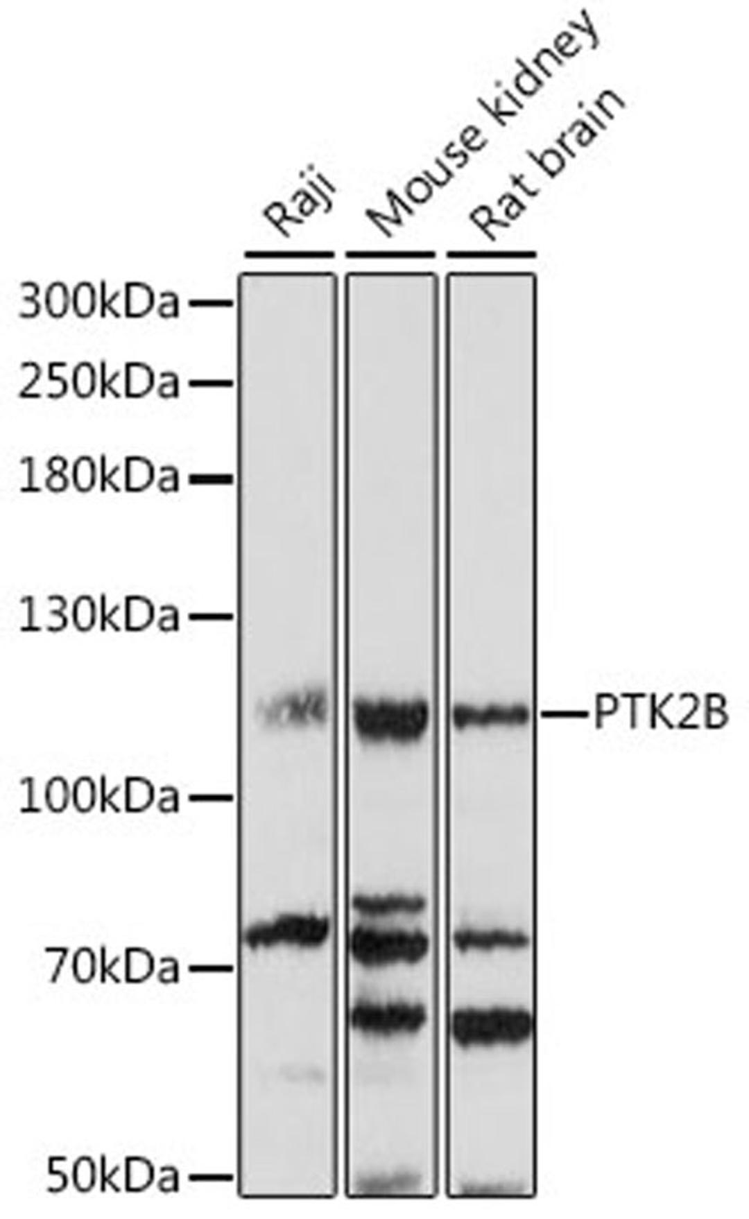 Western blot - PTK2B antibody (A16045)