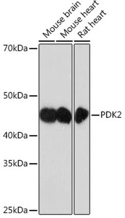 Western blot - PDK2 Rabbit mAb (A4737)