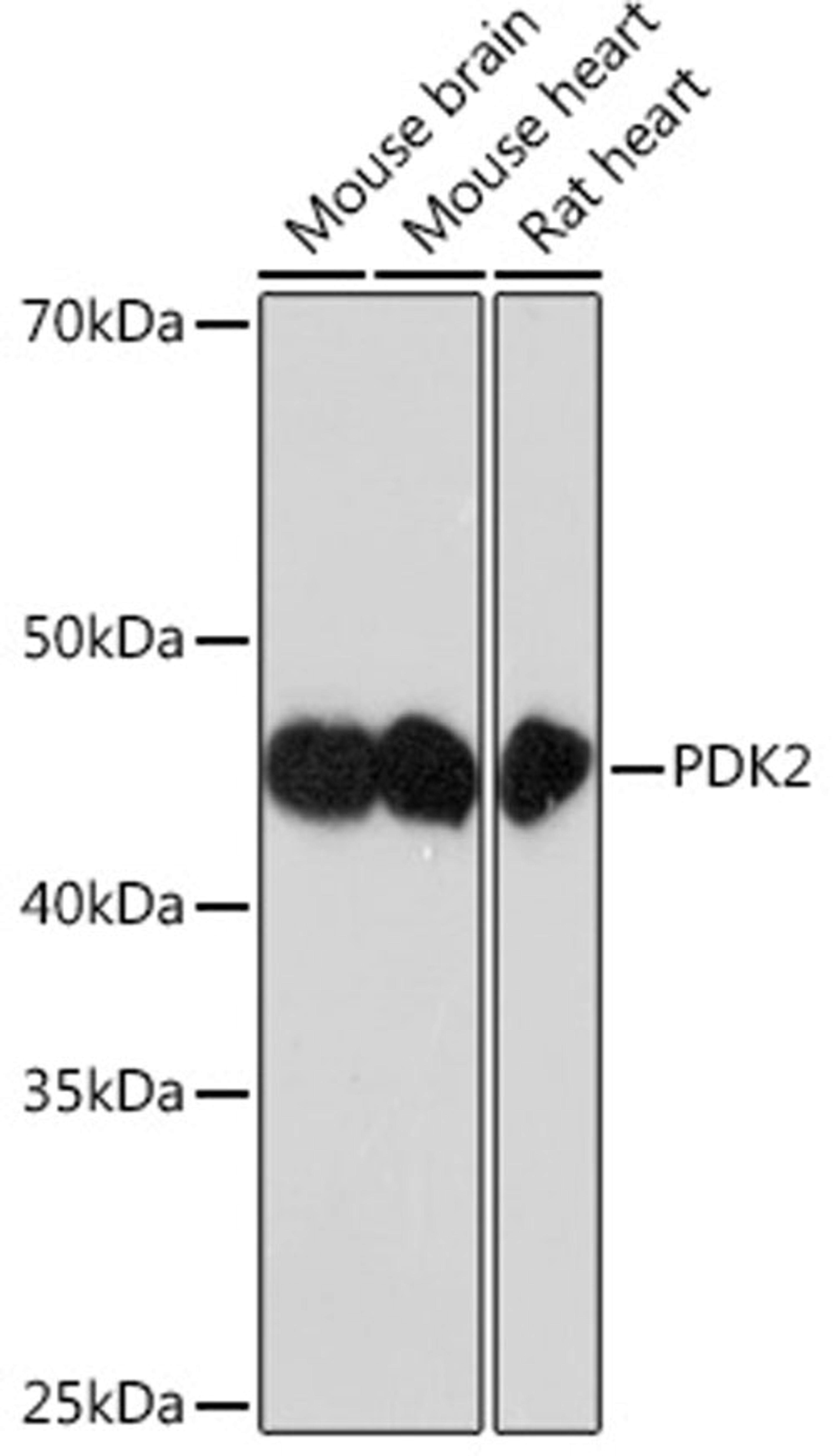 Western blot - PDK2 Rabbit mAb (A4737)