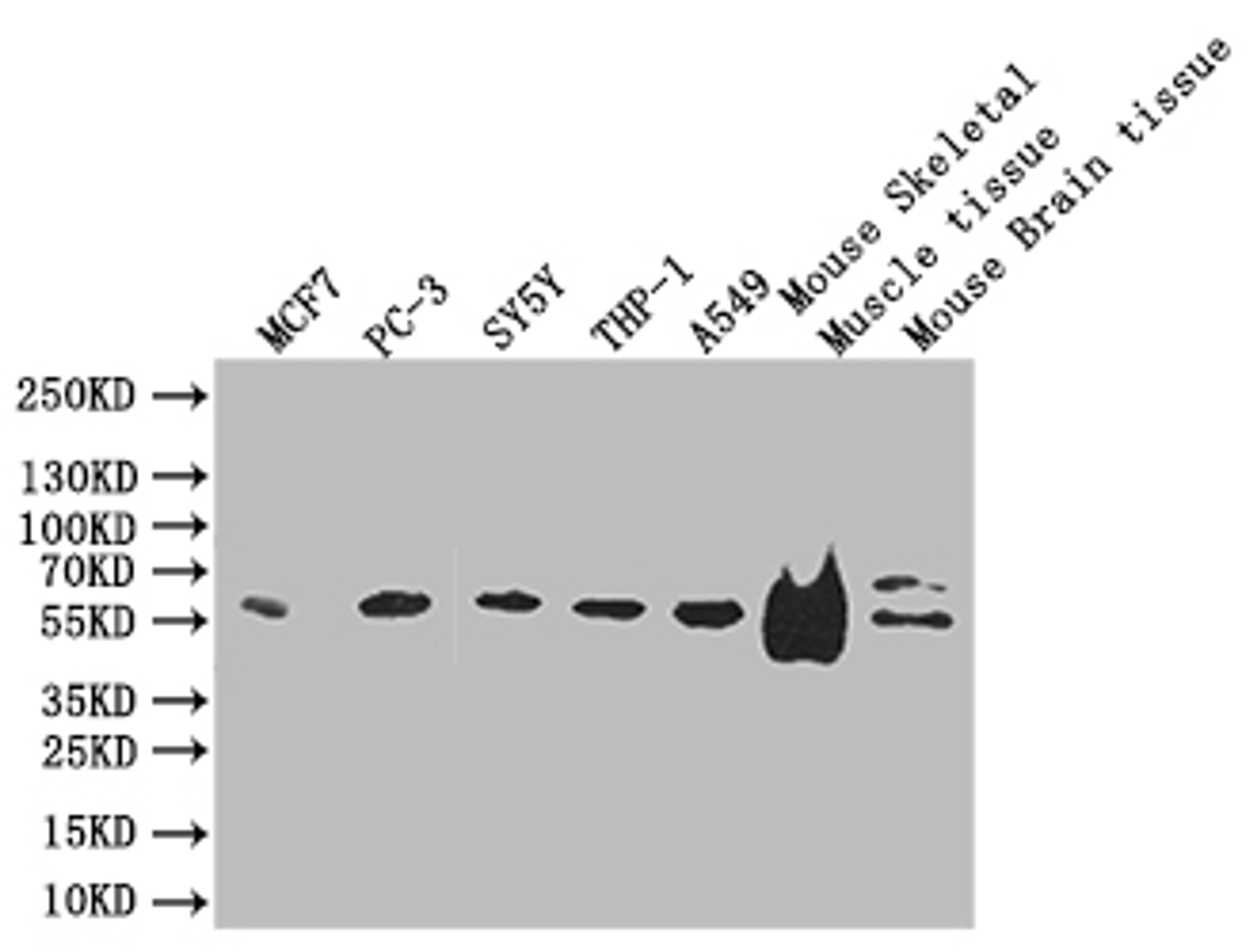 Western blot. All lanes: IFT46 antibody at 8 ug/ml + Mouse skeletal muscle tissue. Secondary. Goat polyclonal to rabbit IgG at 1/10000 dilution. Predicted band size: 35, 41 kDa. Observed band size: 35 kDa.