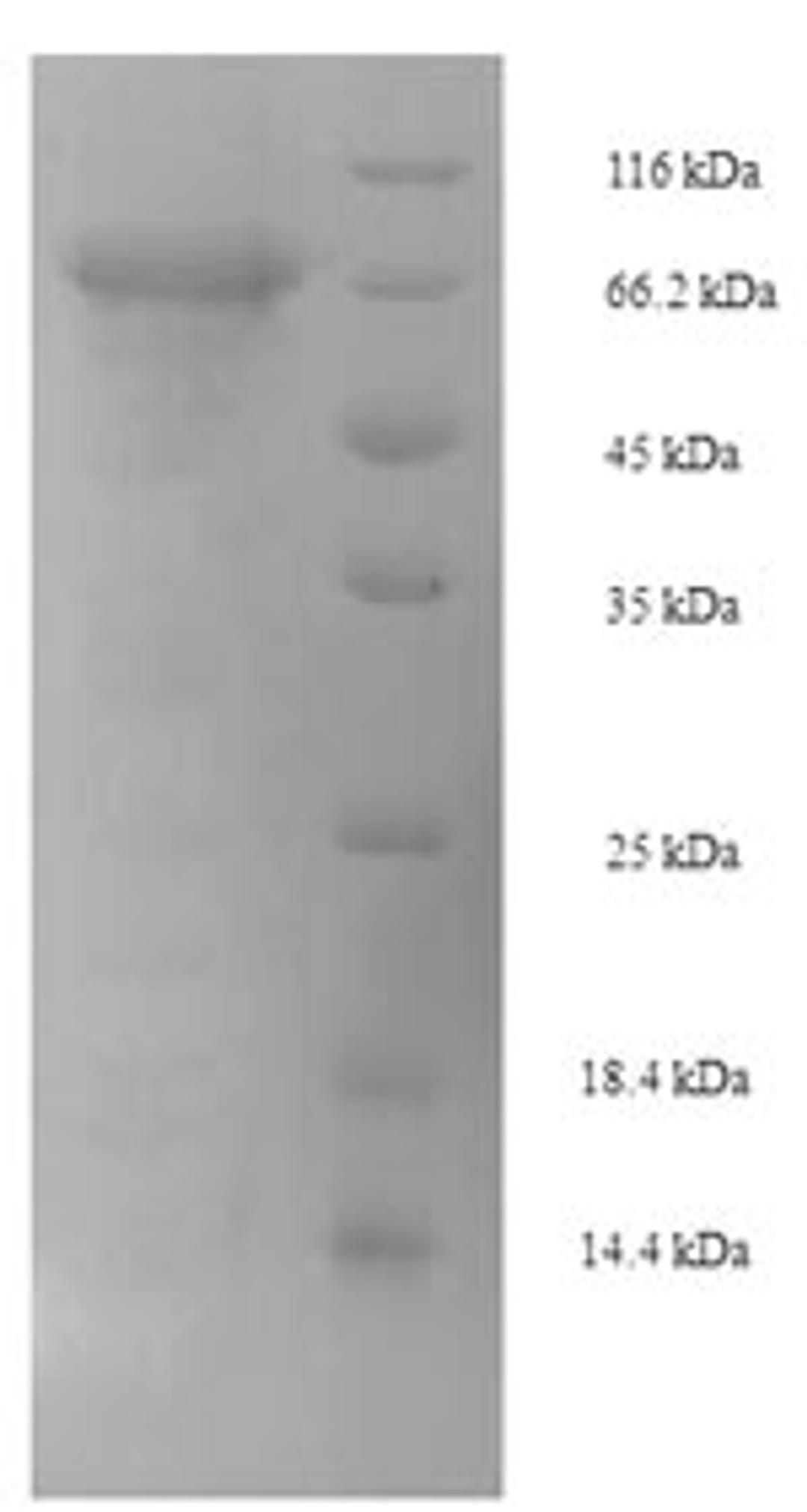 (Tris-Glycine gel) Discontinuous SDS-PAGE (reduced) with 5% enrichment gel and 15% separation gel.