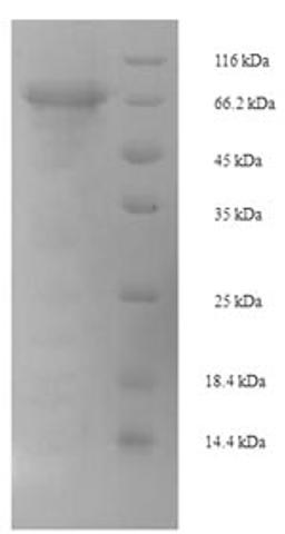 (Tris-Glycine gel) Discontinuous SDS-PAGE (reduced) with 5% enrichment gel and 15% separation gel.