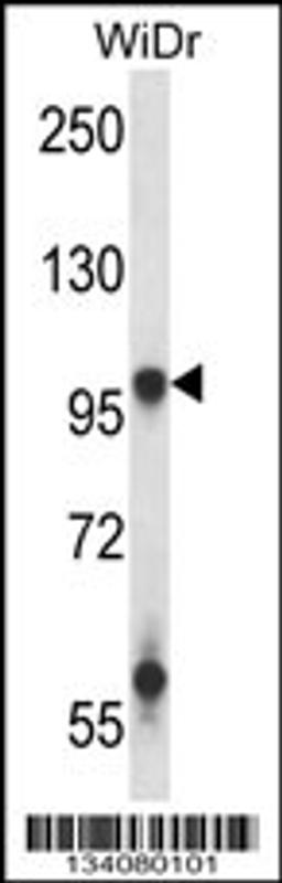 Western blot analysis in WiDr cell line lysates (35ug/lane).