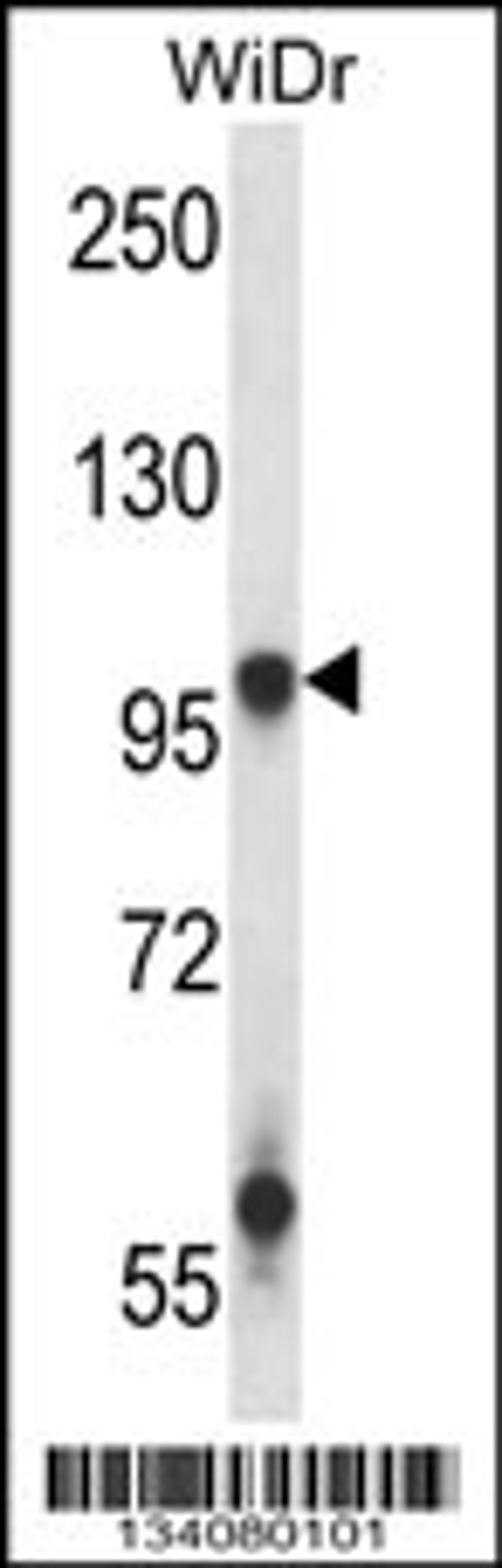 Western blot analysis in WiDr cell line lysates (35ug/lane).