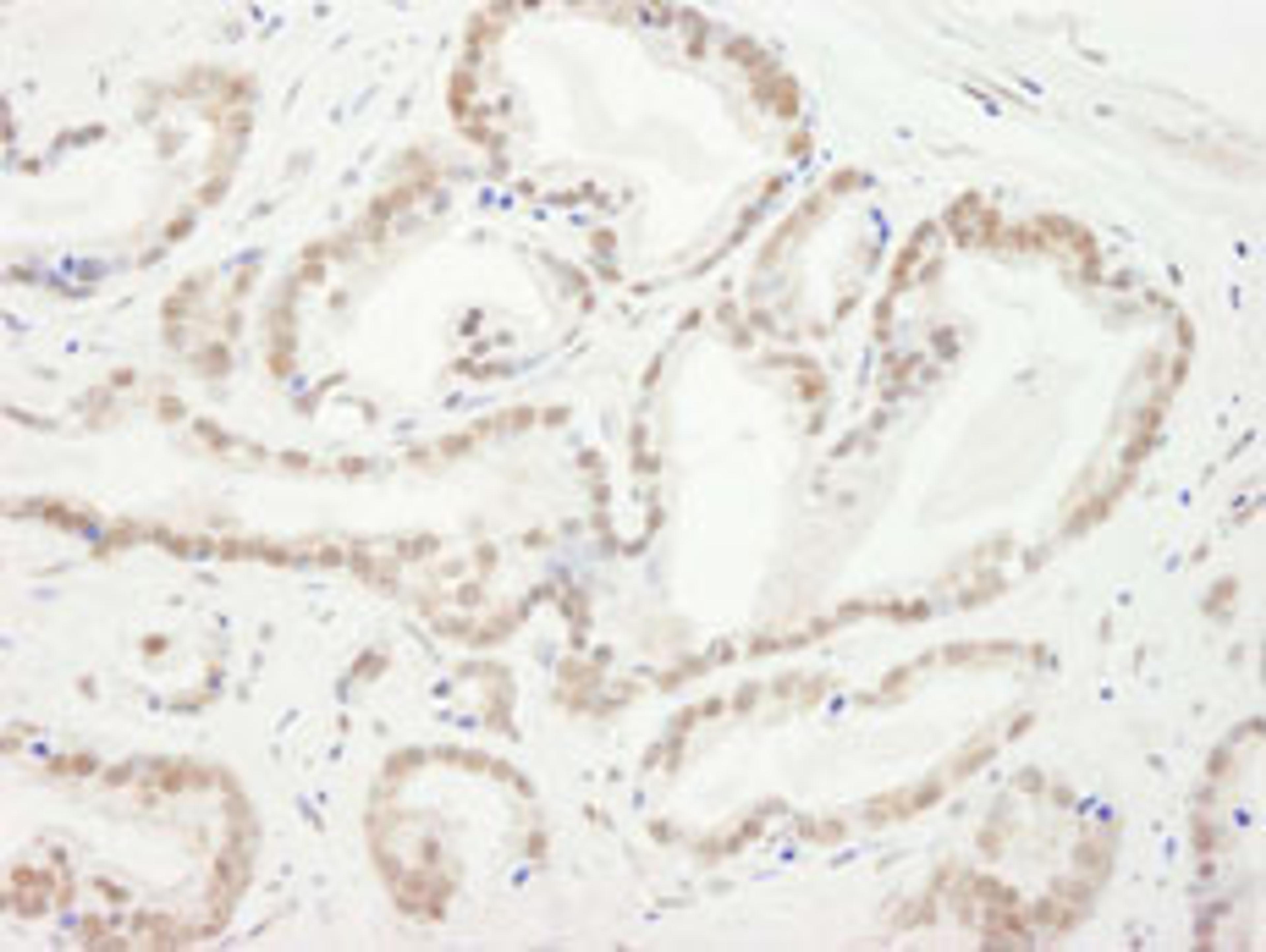 Detection of human CBX5 by immunohistochemistry.