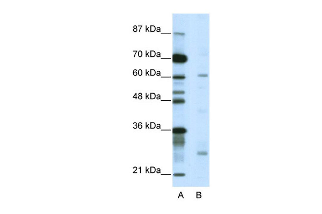 Antibody used in WB on Human Jurkat 5.0 ug/ml.