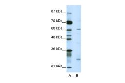 Antibody used in WB on Human Jurkat 5.0 ug/ml.