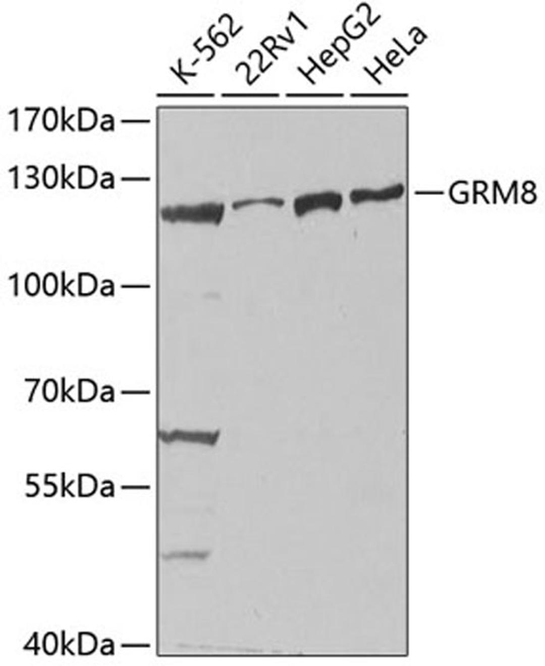 Western blot - GRM8 antibody (A2964)