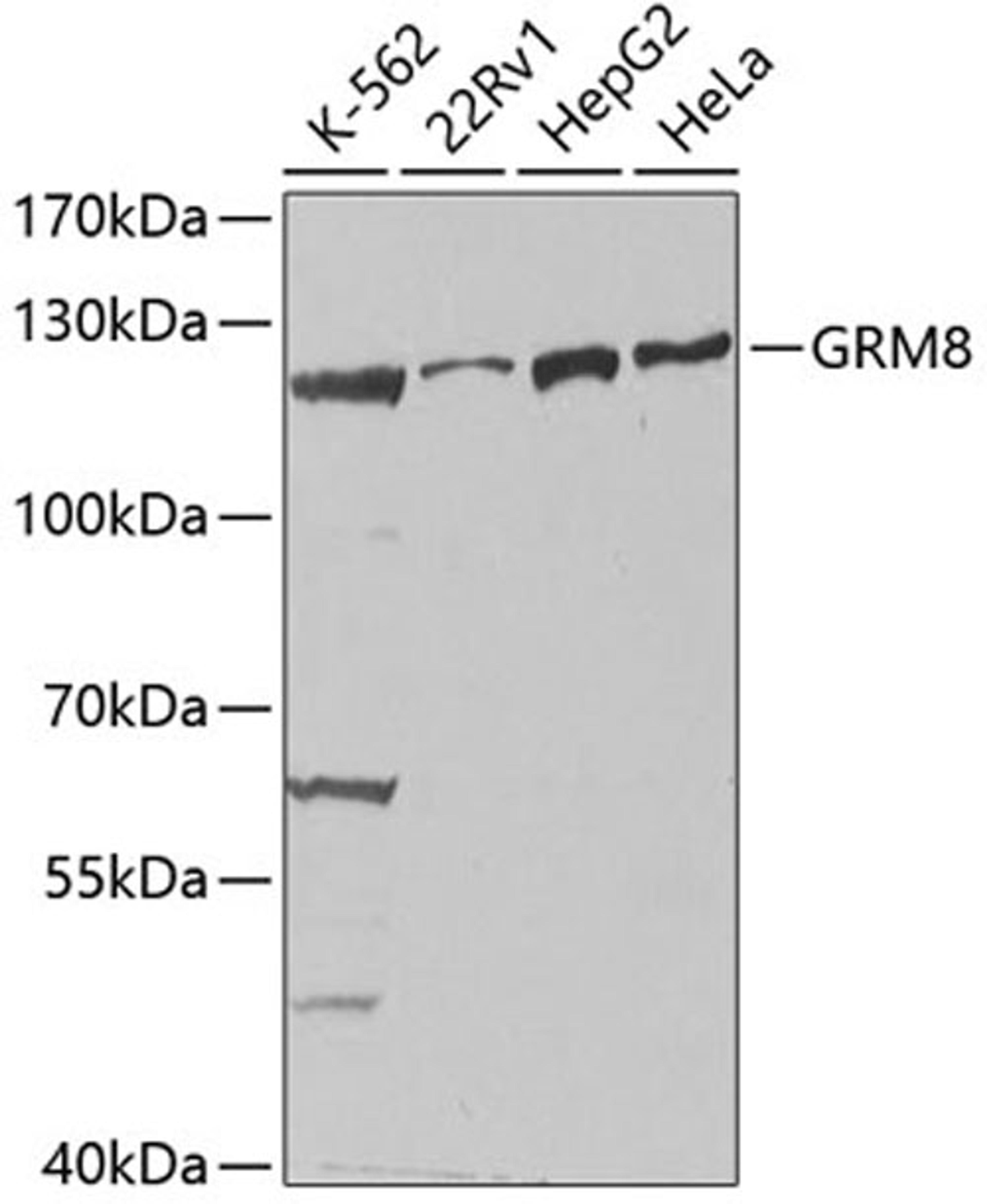 Western blot - GRM8 antibody (A2964)