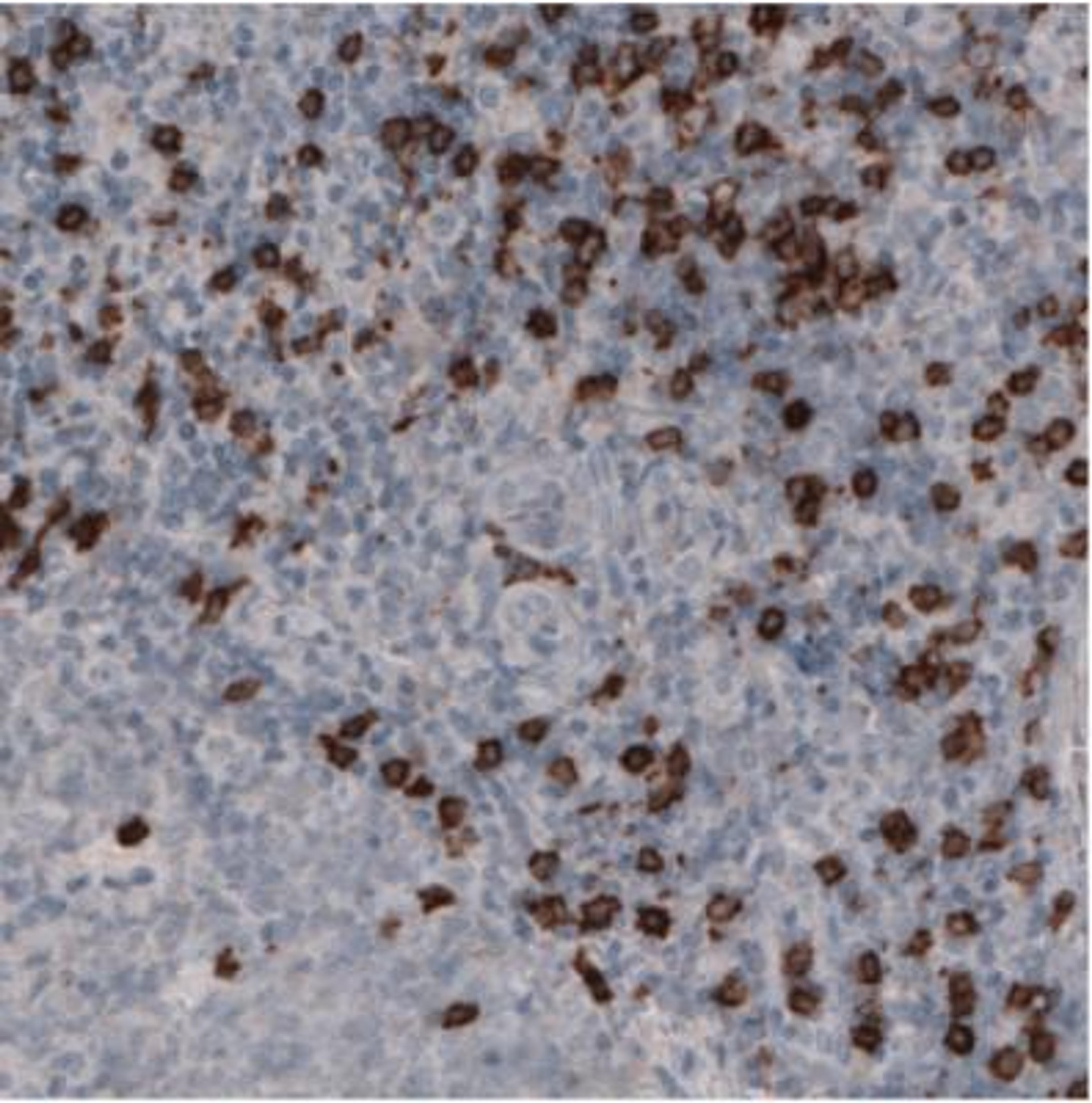 Immunohistochemistry: Cd8a Antibody (CL1529) [NBP2-36743] - Staining of Human Tonsil shows strong immunoreactiviy of lymphoid cells outside the reaction centra.