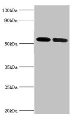 Western blot. All lanes: V-type proton ATPase subunit B, kidney isoform antibody at 7ug/ml. Lane 1: Mouse kidney tissue. Lane 2: 293T whole cell lysate. Secondary. Goat polyclonal to rabbit IgG at 1/10000 dilution. Predicted band size: 57 kDa. Observed band size: 57 kDa.
