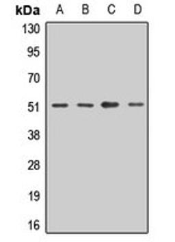 Western blot analysis of HepG2 (Lane1), A549 (Lane2), mouse brain (Lane3), rat testis (Lane4) whole cell lysates using DDOST antibody