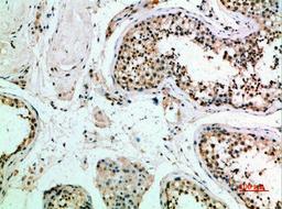 Immunohistochemical analysis of paraffin-embedded human-testis, antibody was diluted at 1:200