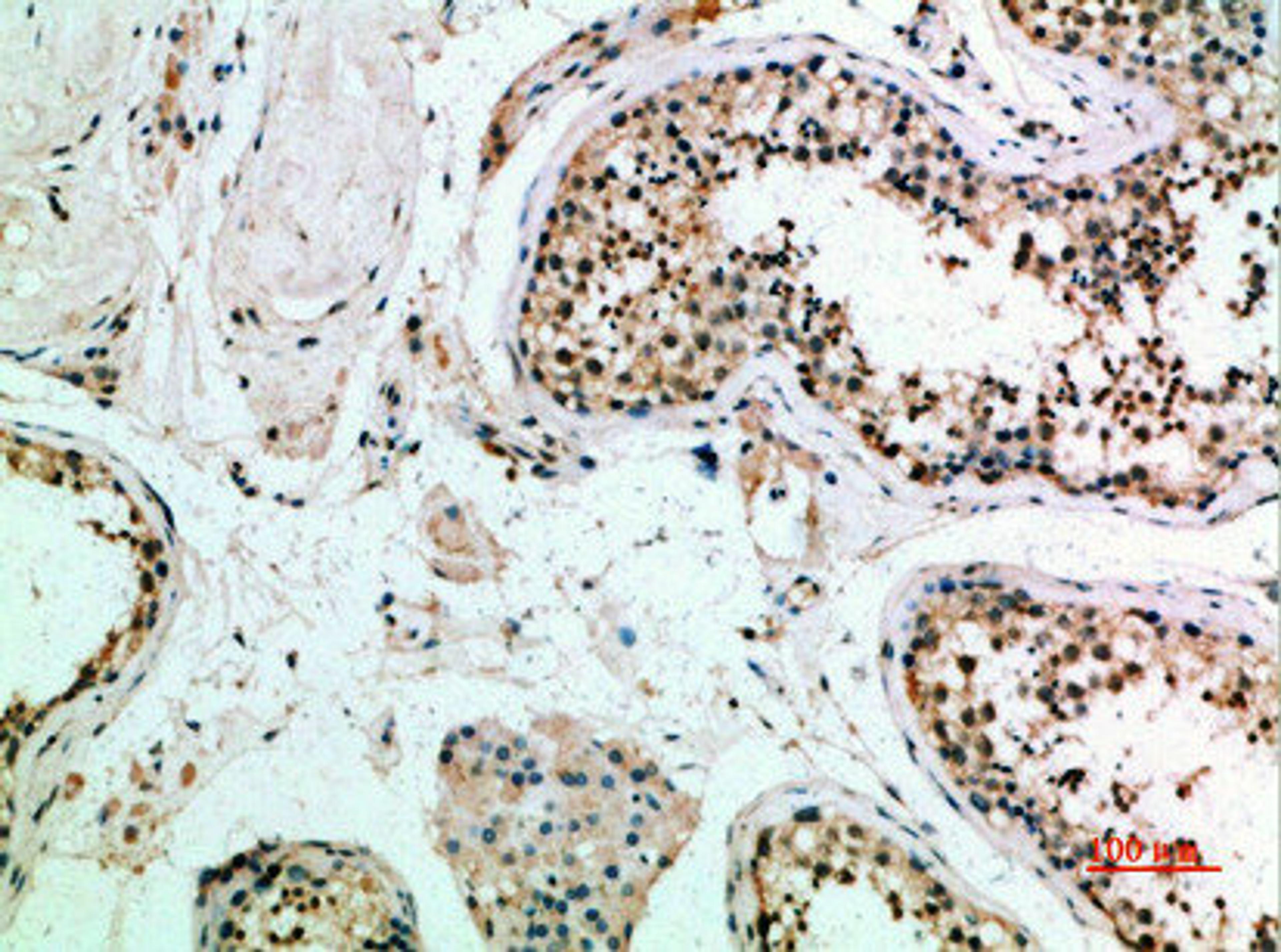 Immunohistochemical analysis of paraffin-embedded human-testis, antibody was diluted at 1:200