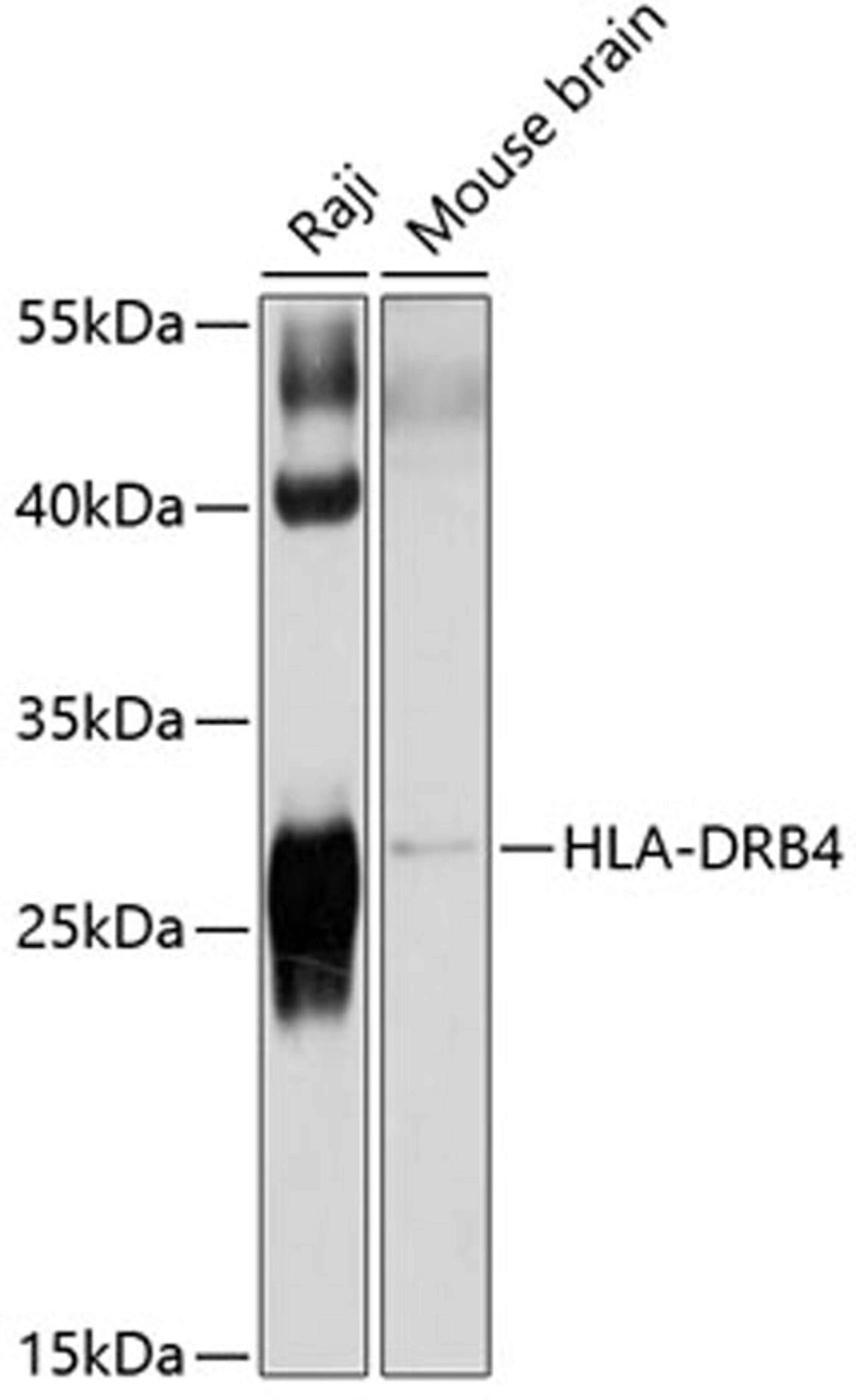 Western blot - HLA-DRB4 antibody (A10078)