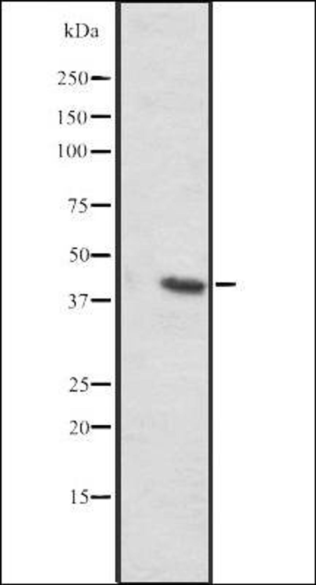 Western blot analysis of Mouse liver lysates using SLC35C2 antibody