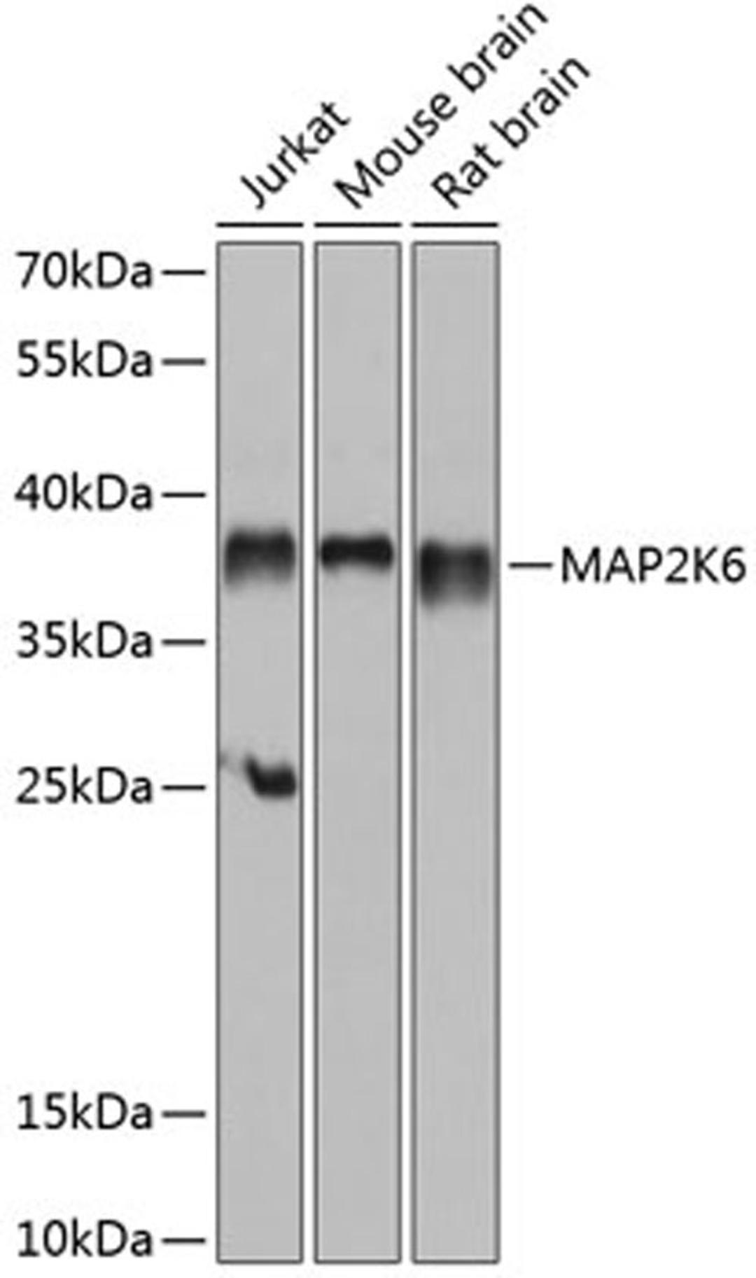 Western blot - MAP2K6 antibody (A14191)