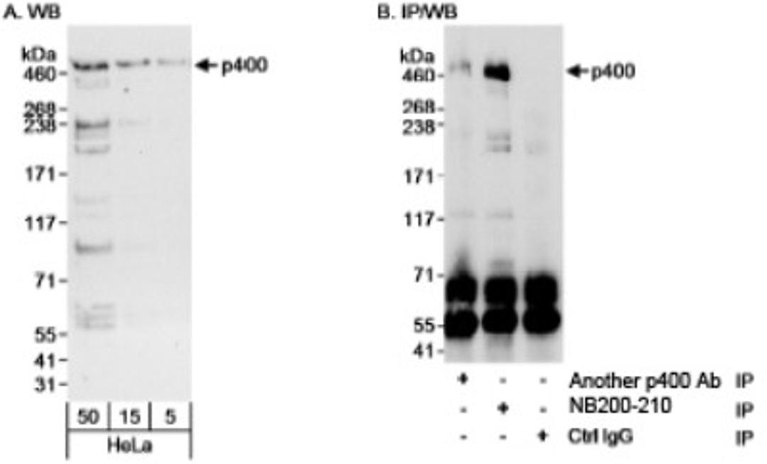 Western Blot: p400 Antibody [NB200-210] - Detection of Human p400 on HeLa whole cell lysate using NB200-210. Immunoprecipitation of  p400 was also accomplished, albeit less efficiently, using another rabbit  anti-p400 antibody.