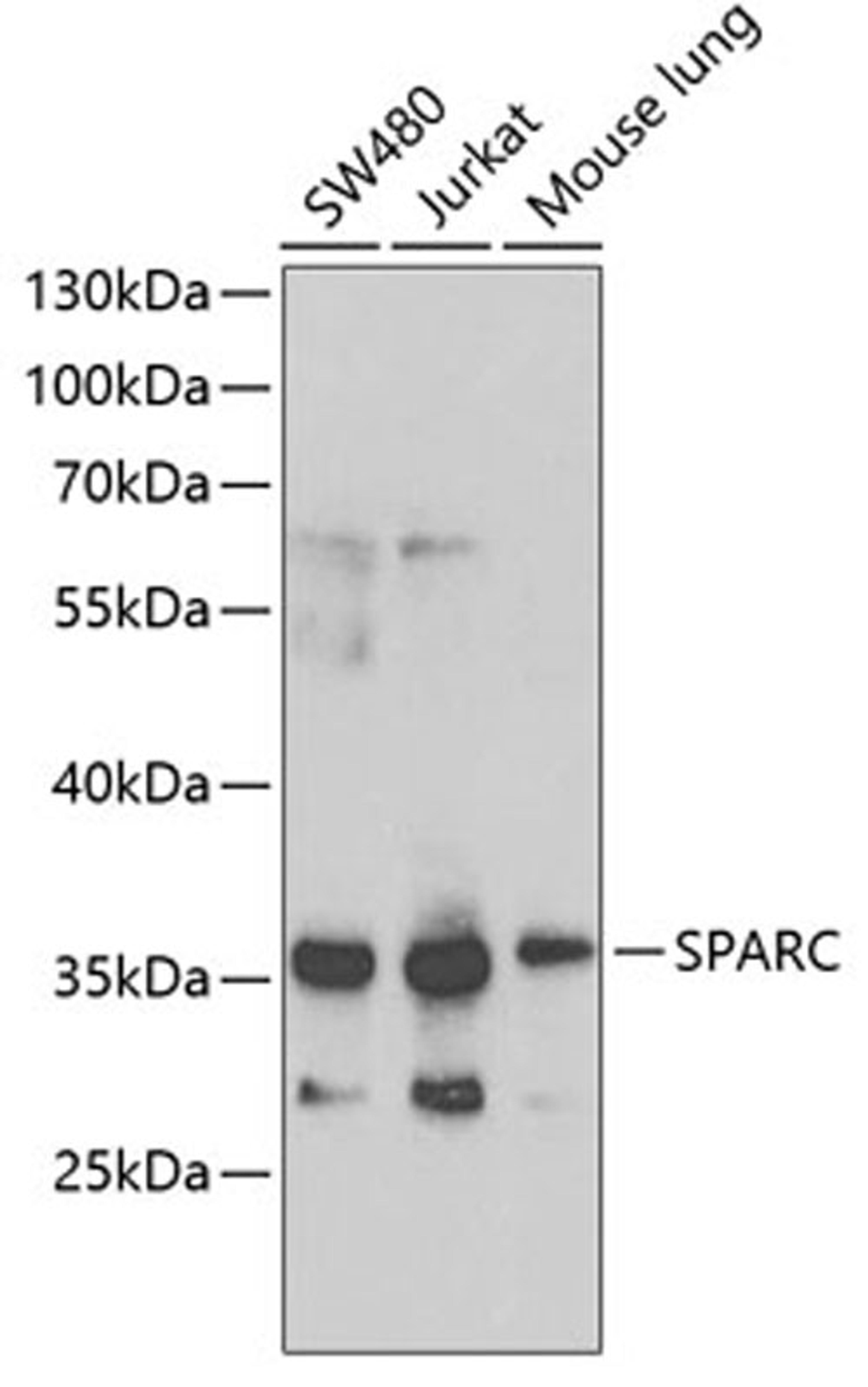 Western blot - SPARC antibody (A1615)