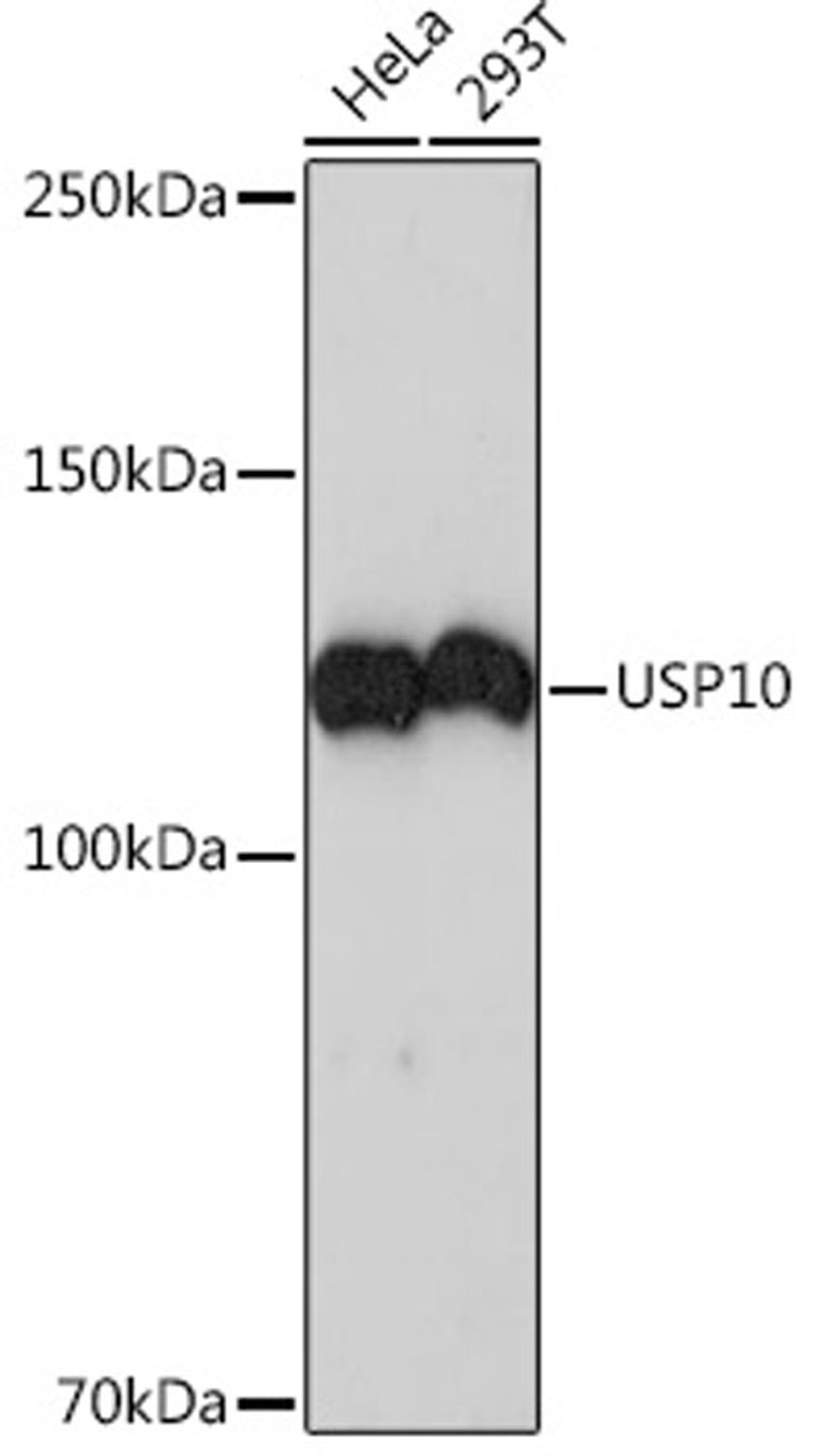 Western blot - USP10  Rabbit mAb (A4454)