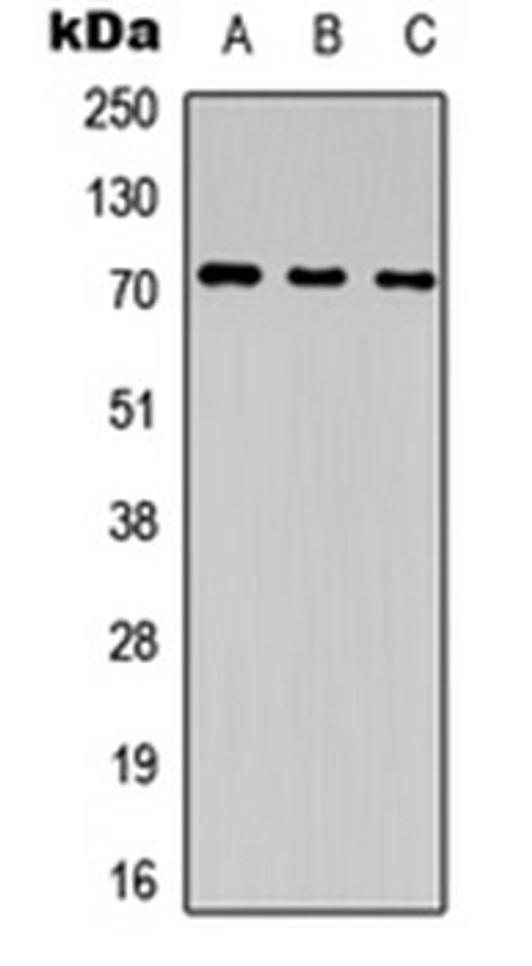 Western blot analysis of HEK293T (Lane 1), NS-1 (Lane 2), PC12 (Lane 3) whole cell lysates using CD85j antibody