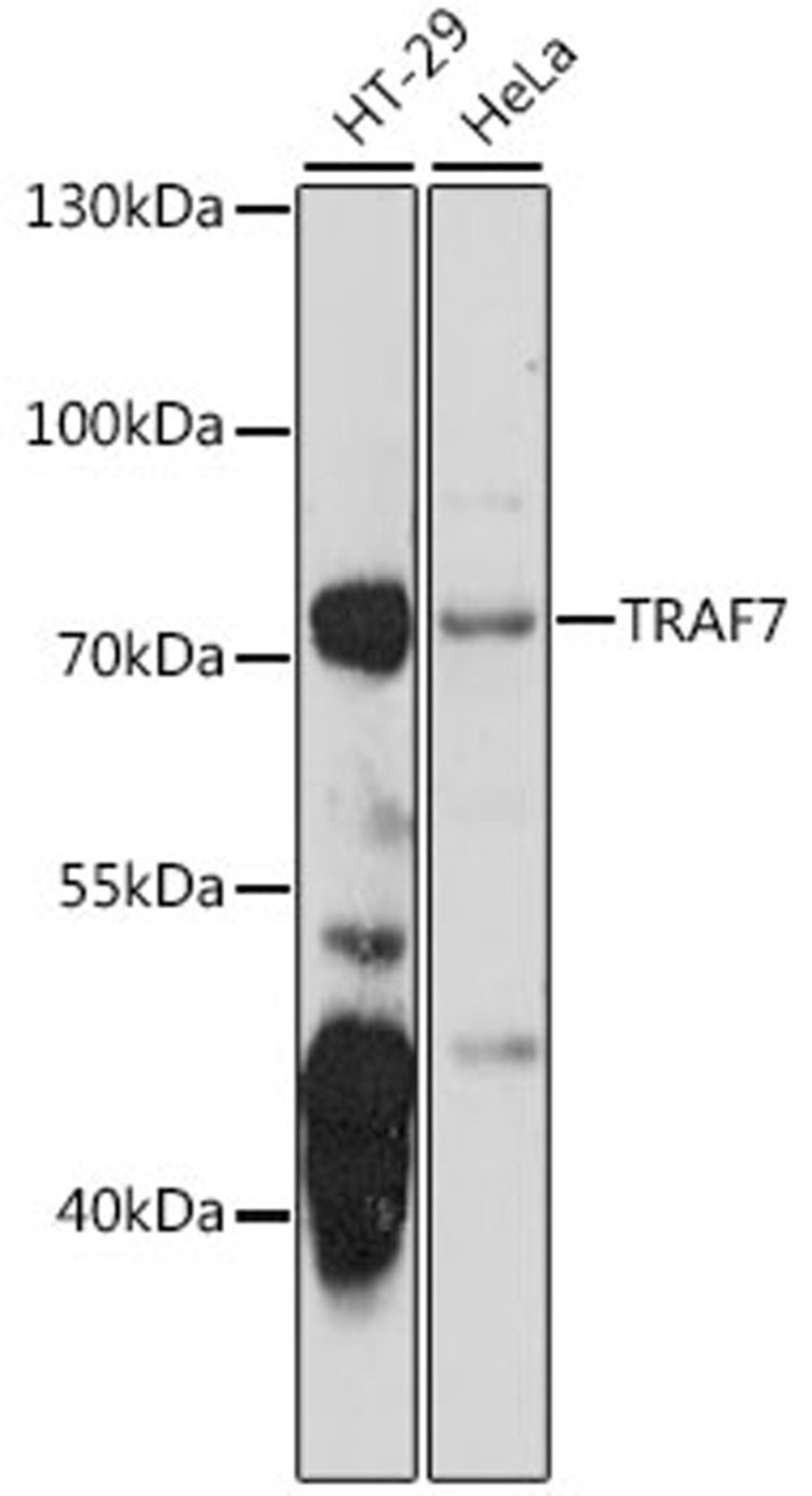 Western blot - TRAF7 antibody (A15607)