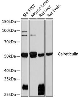 Western blot - Calreticulin Rabbit mAb (A11563)