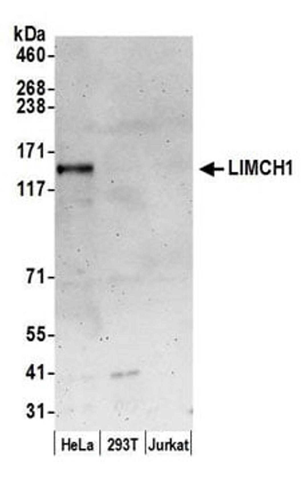 Detection of human LIMCH1 by western blot.