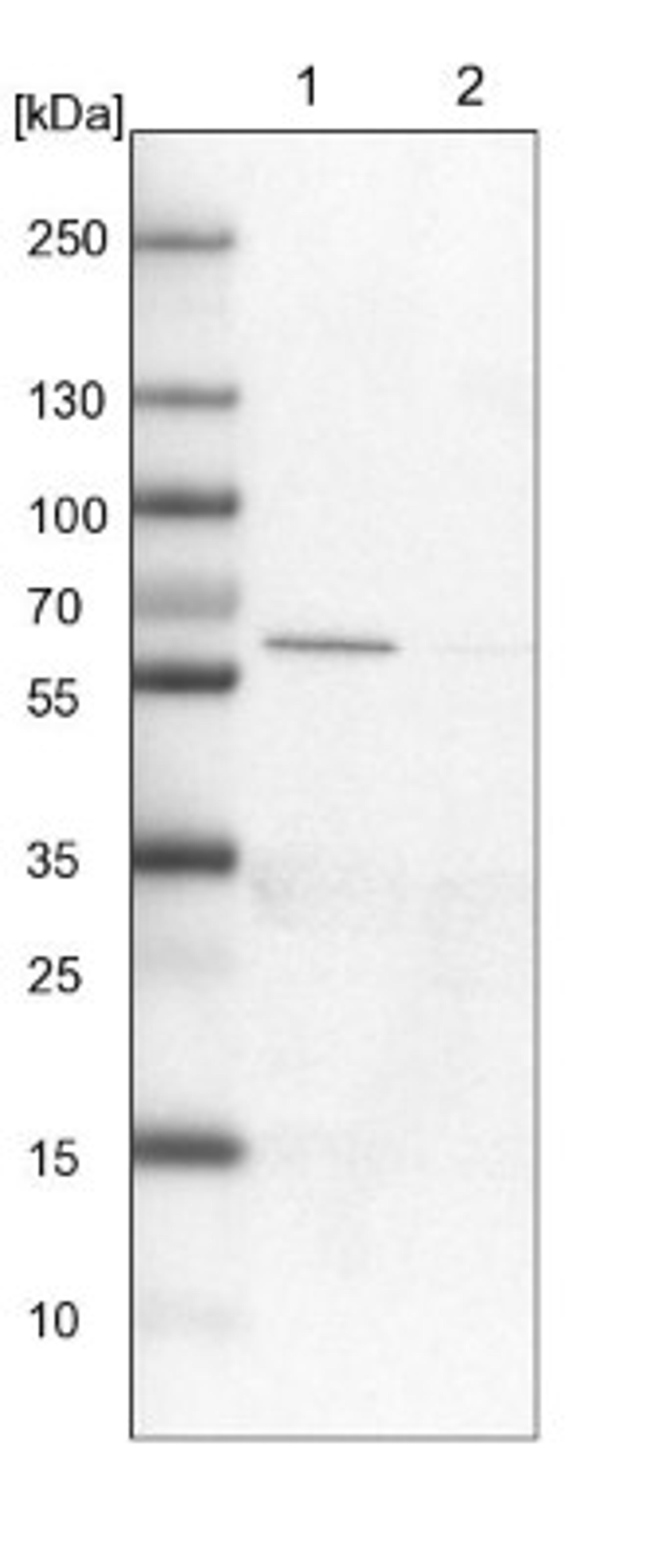 Western Blot: GAT-1/SLC6A1 Antibody [NBP1-89802] - Lane 1: NIH-3T3 cell lysate (Mouse embryonic fibroblast cells)<br/>Lane 2: NBT-II cell lysate (Rat Wistar bladder tumour cells)