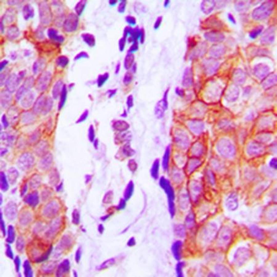 Immunohistochemical analysis of formalin-fixed and paraffin-embedded human prostate tissue using Cystatin 11 antibody