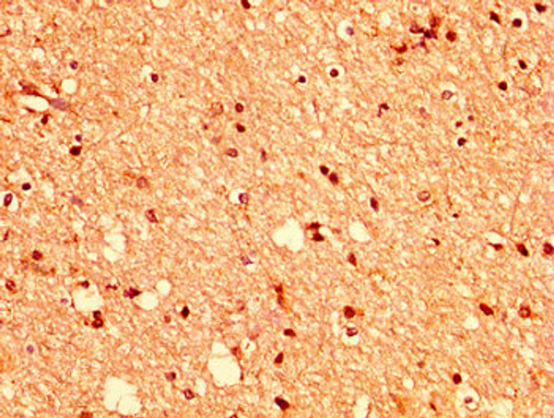 IHC image of CSB-PA007722LA01HU diluted at 1:400 and staining in paraffin-embedded human brain tissue performed on a Leica BondTM system. After dewaxing and hydration, antigen retrieval was mediated by high pressure in a citrate buffer (pH 6.0). Section was blocked with 10% normal goat serum 30min at RT. Then primary antibody (1% BSA) was incubated at 4&deg;C overnight. The primary is detected by a biotinylated secondary antibody and visualized using an HRP conjugated SP system.