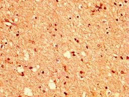 IHC image of CSB-PA007722LA01HU diluted at 1:400 and staining in paraffin-embedded human brain tissue performed on a Leica BondTM system. After dewaxing and hydration, antigen retrieval was mediated by high pressure in a citrate buffer (pH 6.0). Section was blocked with 10% normal goat serum 30min at RT. Then primary antibody (1% BSA) was incubated at 4&deg;C overnight. The primary is detected by a biotinylated secondary antibody and visualized using an HRP conjugated SP system.
