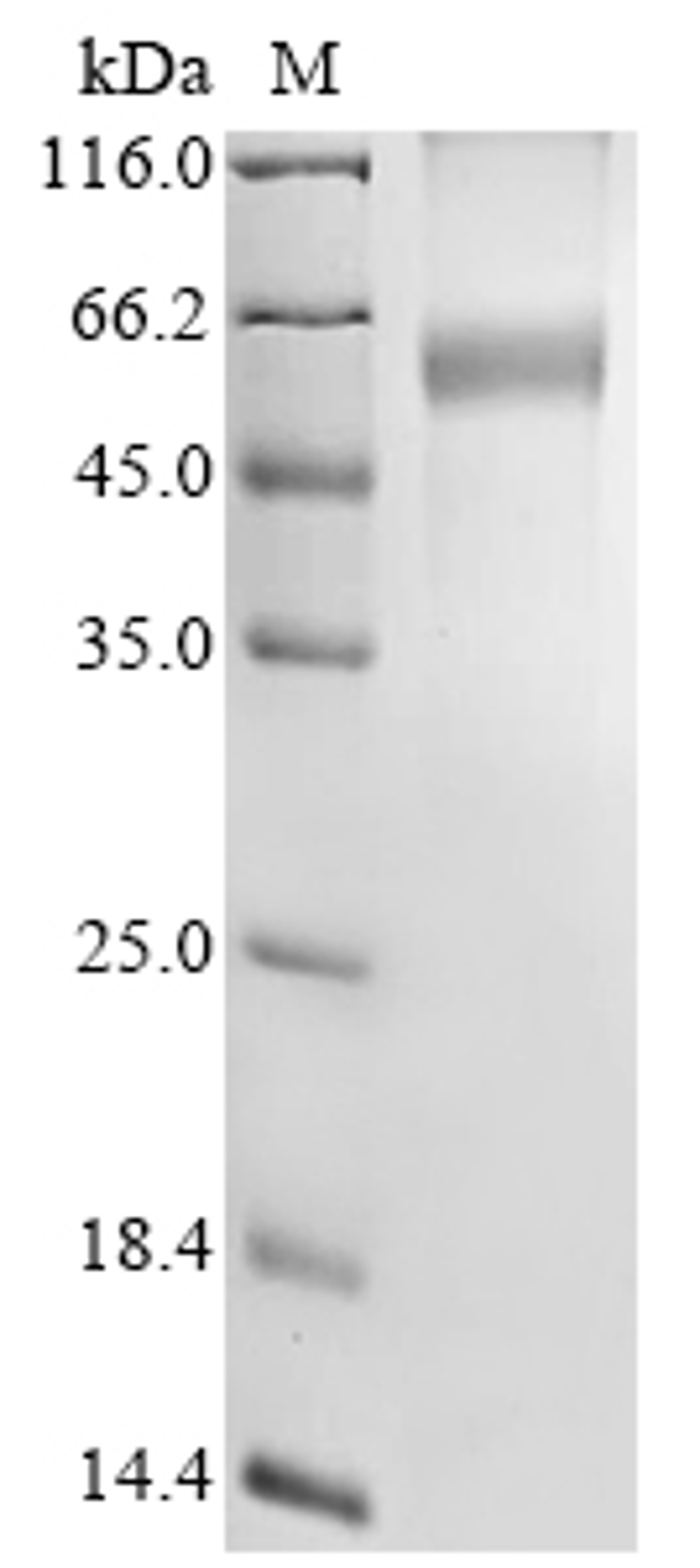 (Tris-Glycine gel) Discontinuous SDS-PAGE (reduced) with 5% enrichment gel and 15% separation gel.