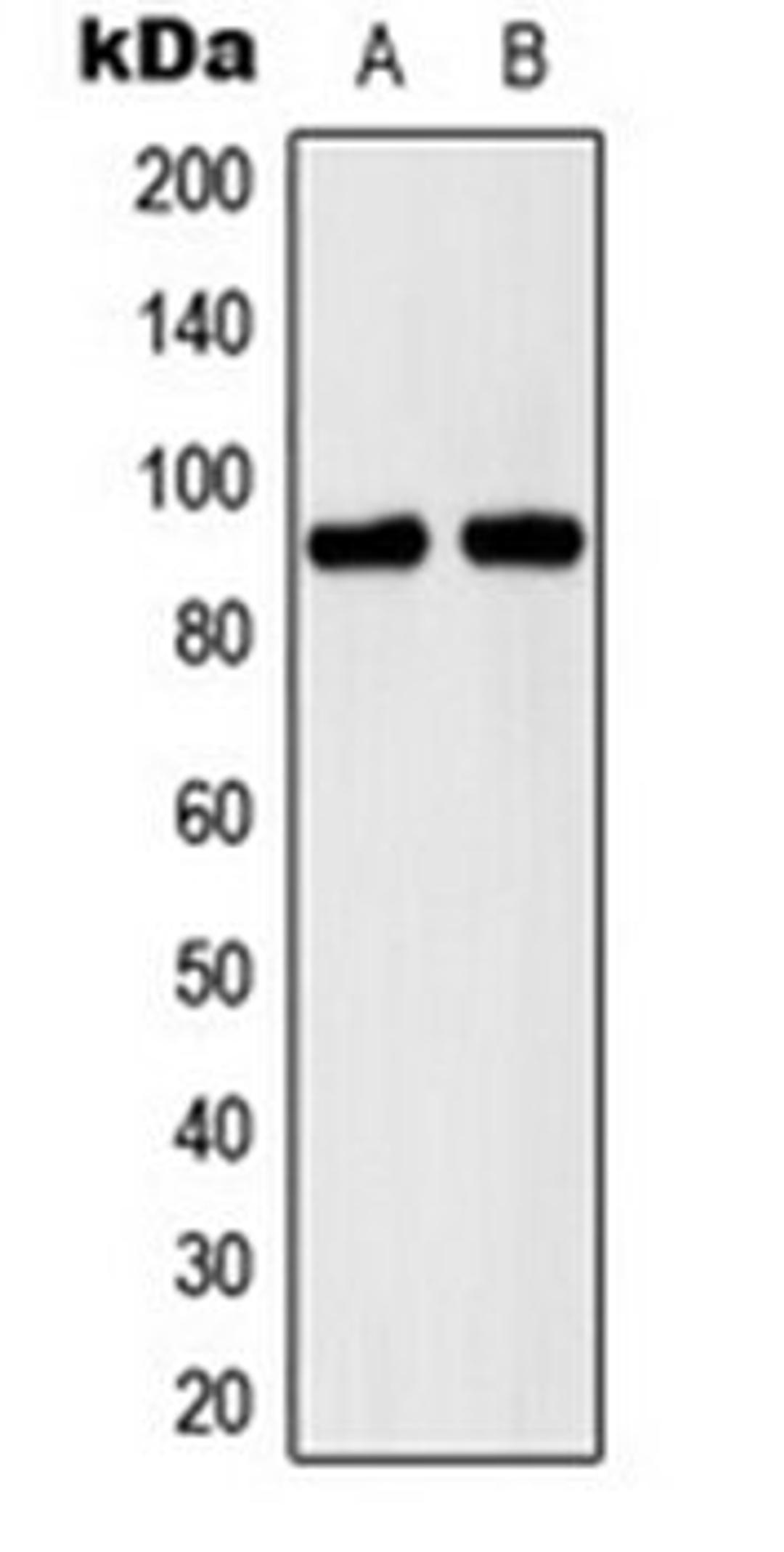 Western blot analysis of A673 (Lane 1), Raw264.7 (Lane 2) whole cell lysates using CDH15 antibody