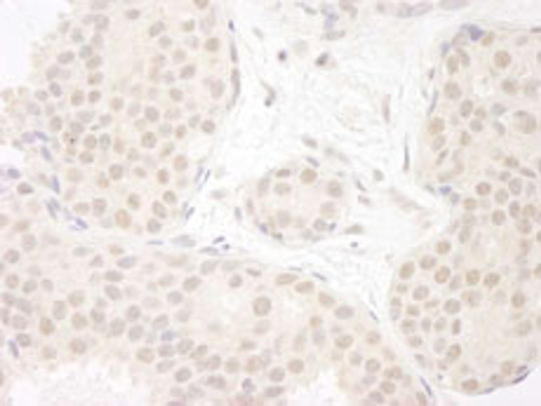 Detection of human DDX23 by immunohistochemistry.