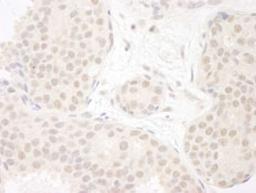 Detection of human DDX23 by immunohistochemistry.