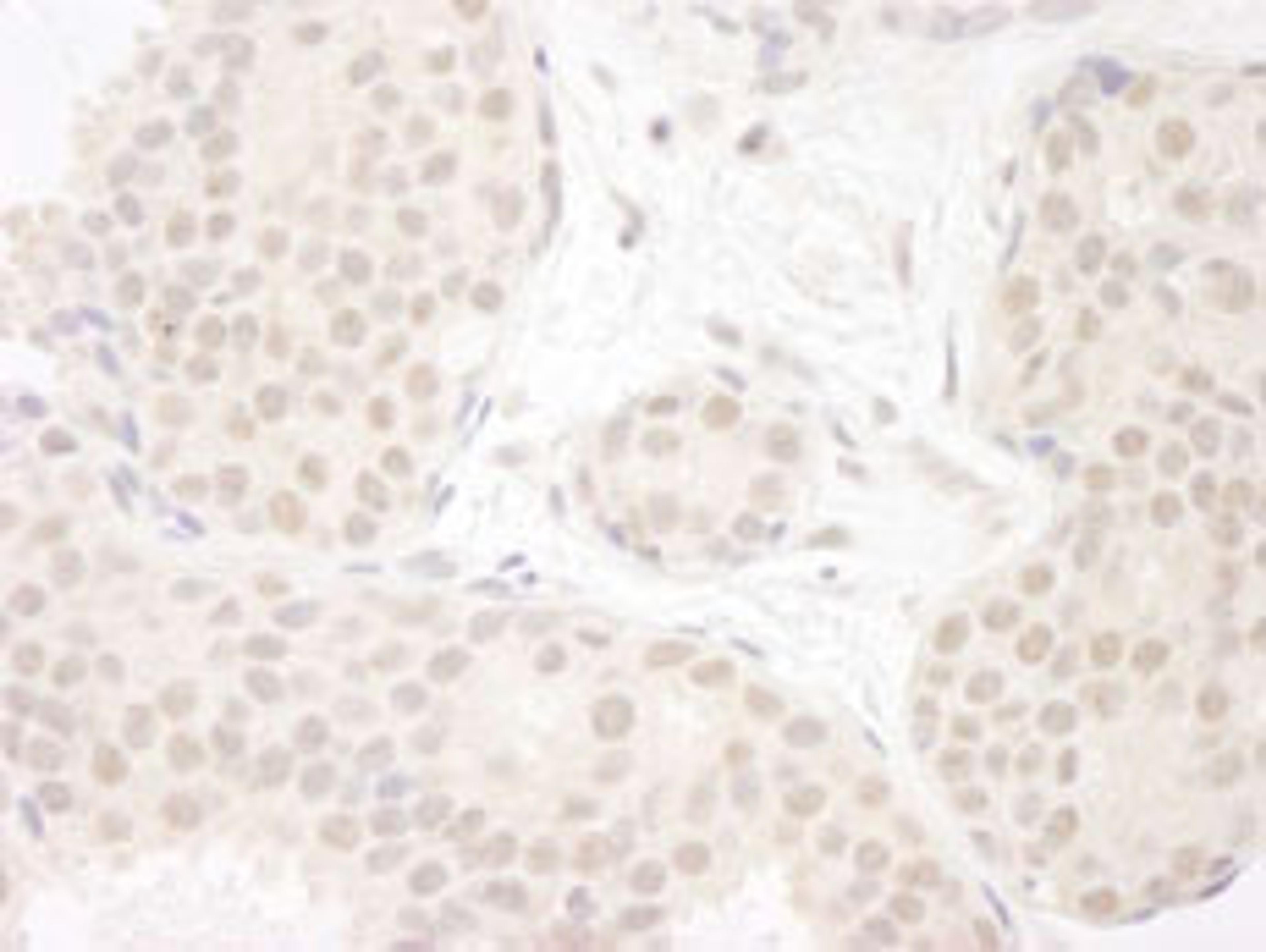 Detection of human DDX23 by immunohistochemistry.