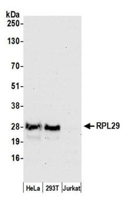 Detection of human RPL29 by western blot.