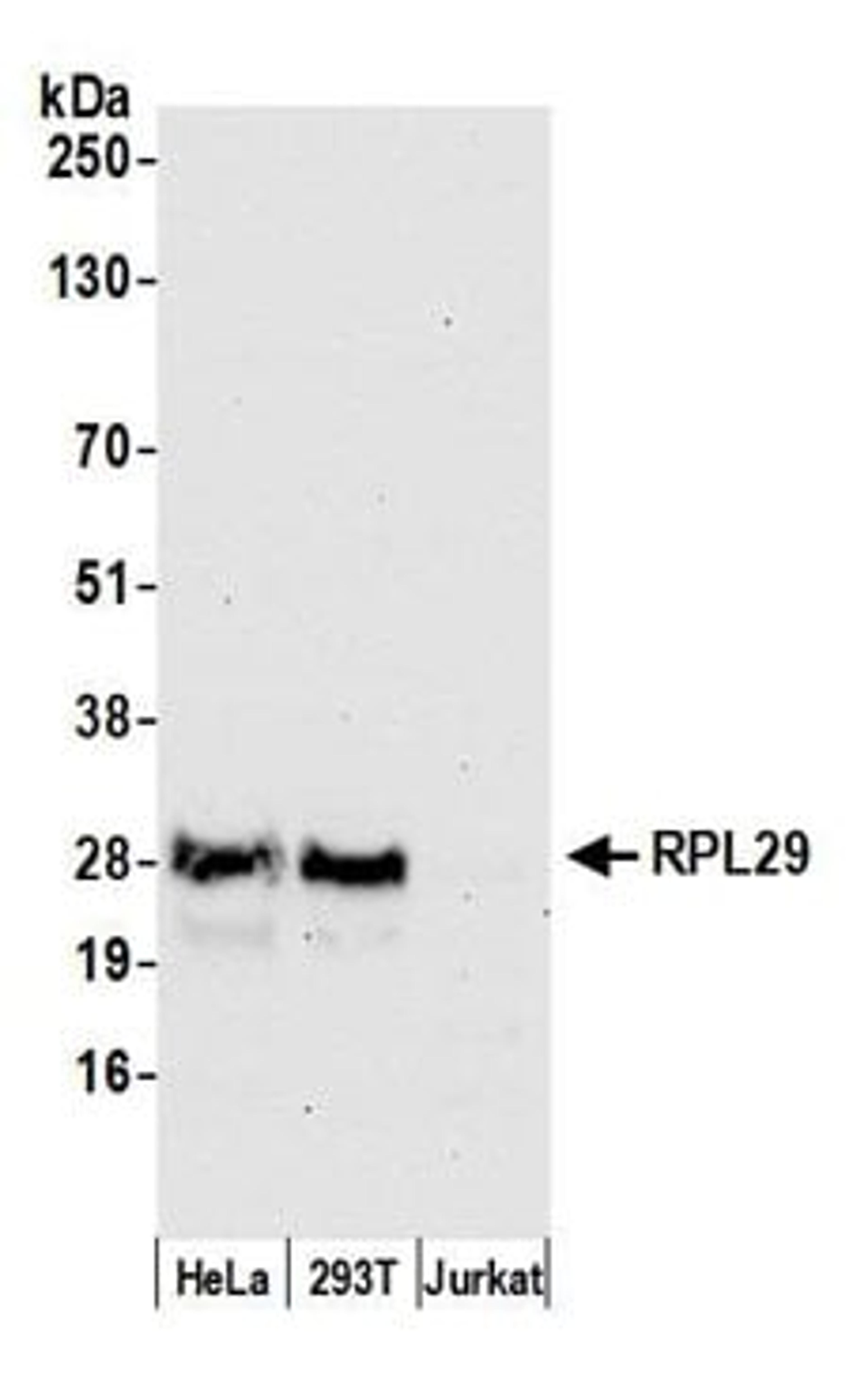 Detection of human RPL29 by western blot.