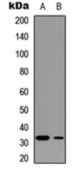 Western blot analysis of MDA-MB-361 (Lane 1), SHSY5Y (Lane 2) whole cell lysates using DARPP32 (phospho-T75) antibody