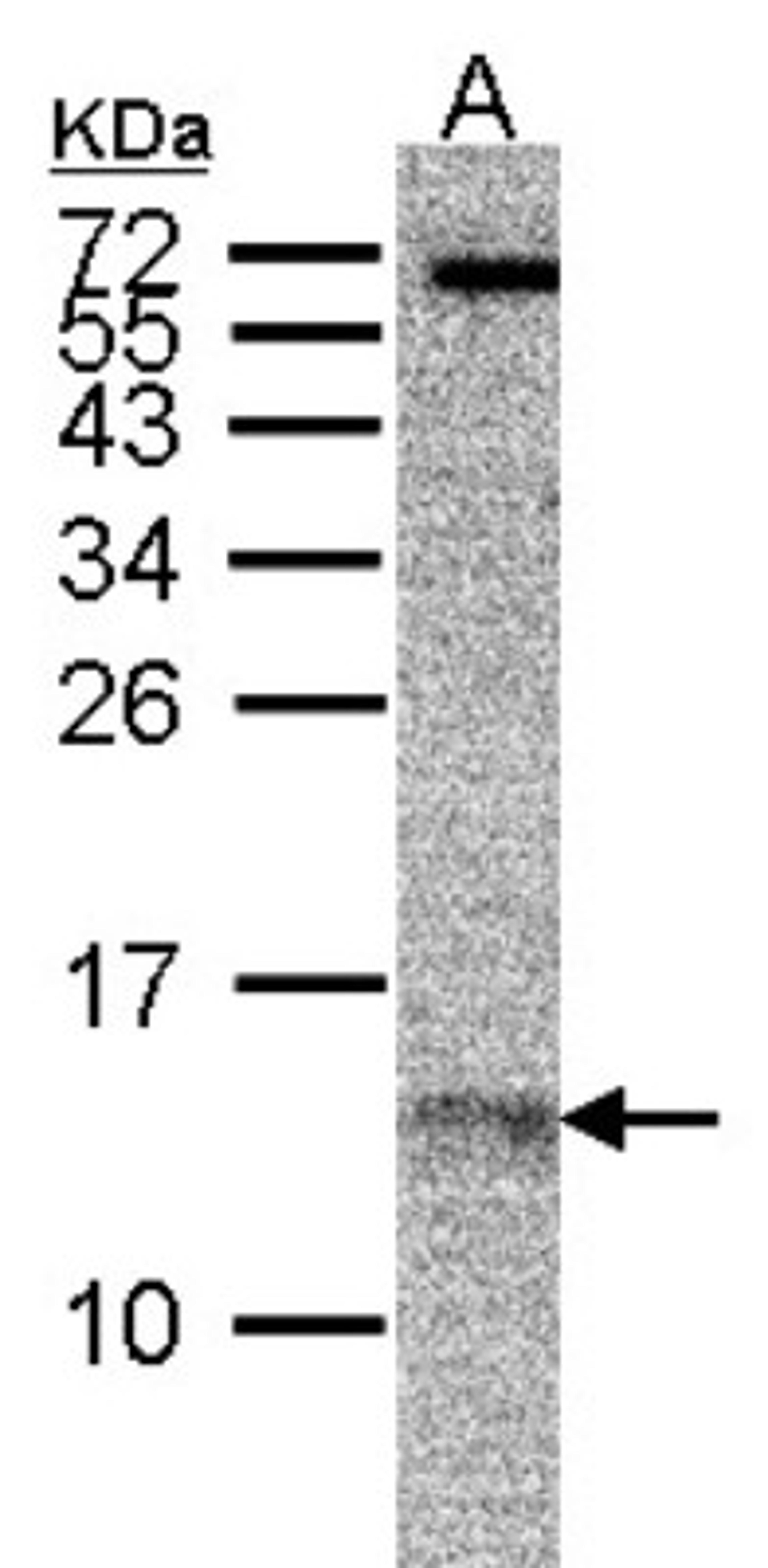 Western Blot: RPA14 Antibody (11.1) [NB100-159] - Sample (30 ug of whole cell lysate) A: MCF7 15% SDS PAGE, antibody diluted at 1:500.