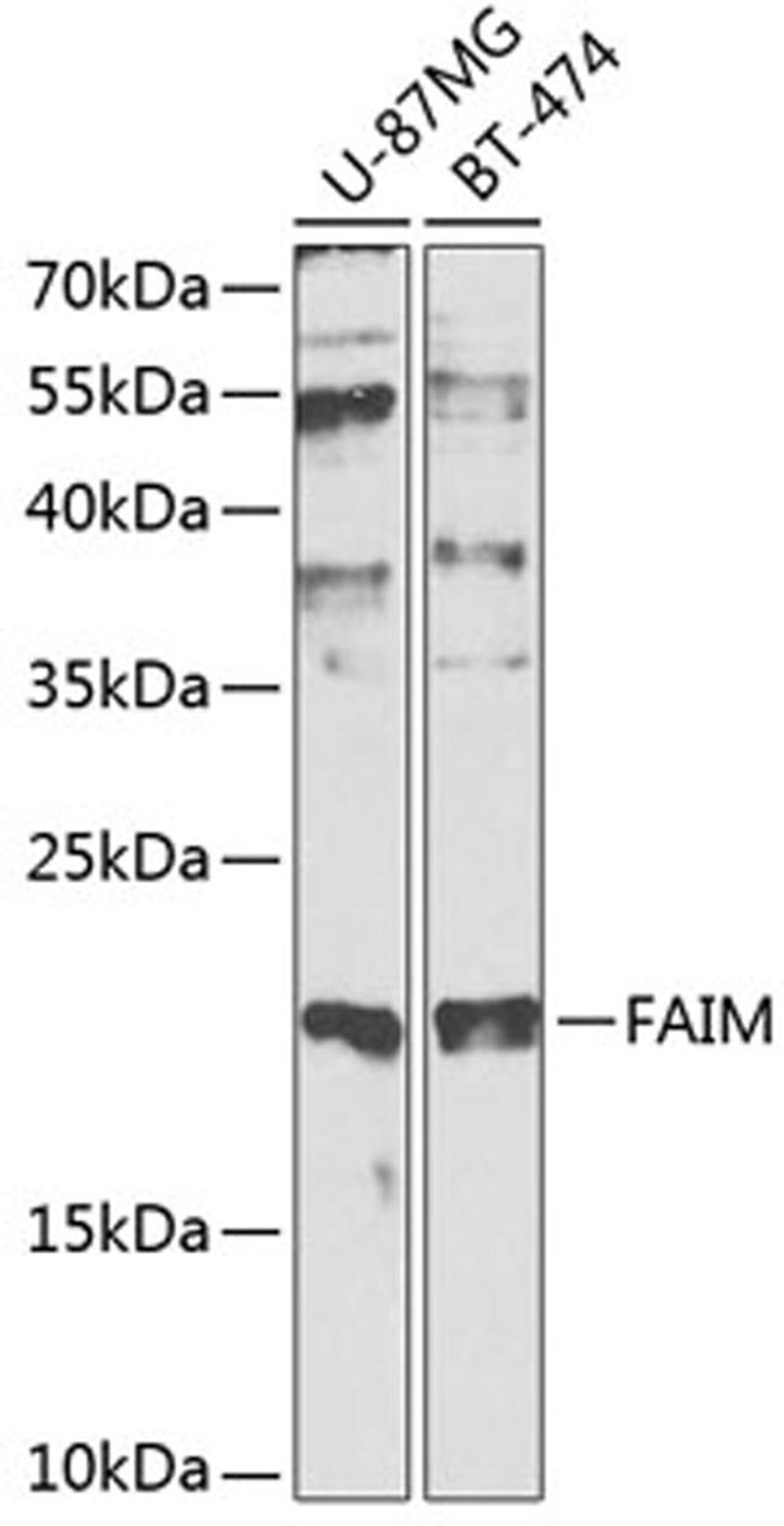 Western blot - FAIM antibody (A0679)