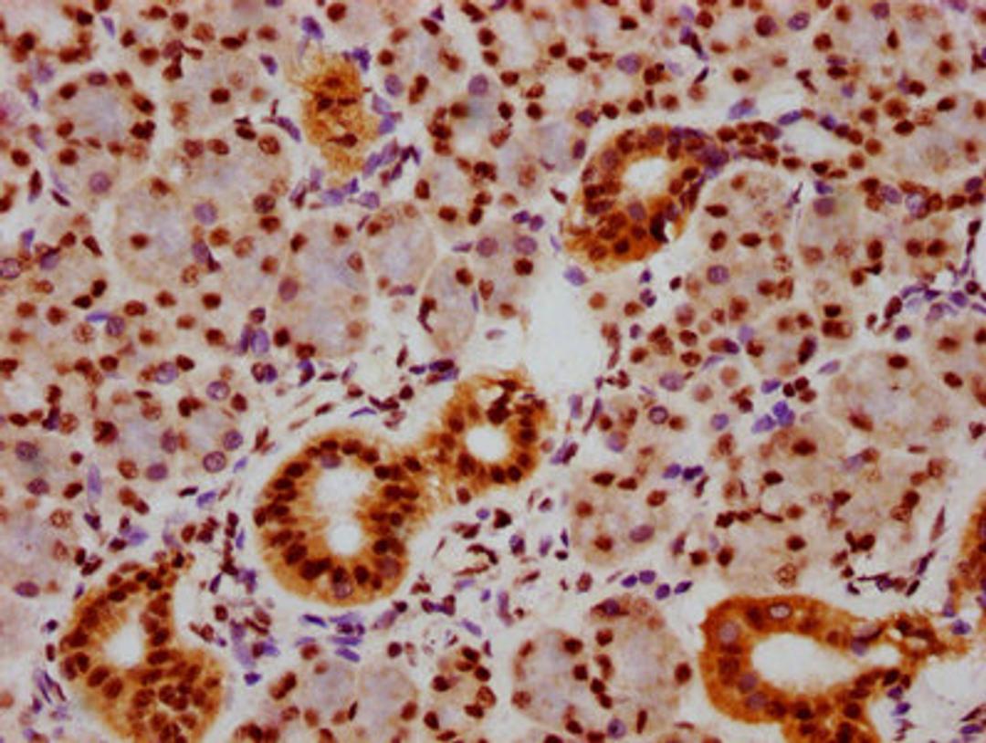 IHC image of CSB-RA859108A463phHU diluted at 1:100 and staining in paraffin-embedded human pancreatic tissue performed on a Leica BondTM system. After dewaxing and hydration, antigen retrieval was mediated by high pressure in a citrate buffer (pH 6.0). Section was blocked with 10% normal goat serum 30min at RT. Then primary antibody (1% BSA) was incubated at 4℃ overnight. The primary is detected by a biotinylated secondary antibody and visualized using an HRP conjugated SP system.