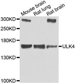 Western blot analysis of extracts of various cell lines using ULK4 antibody