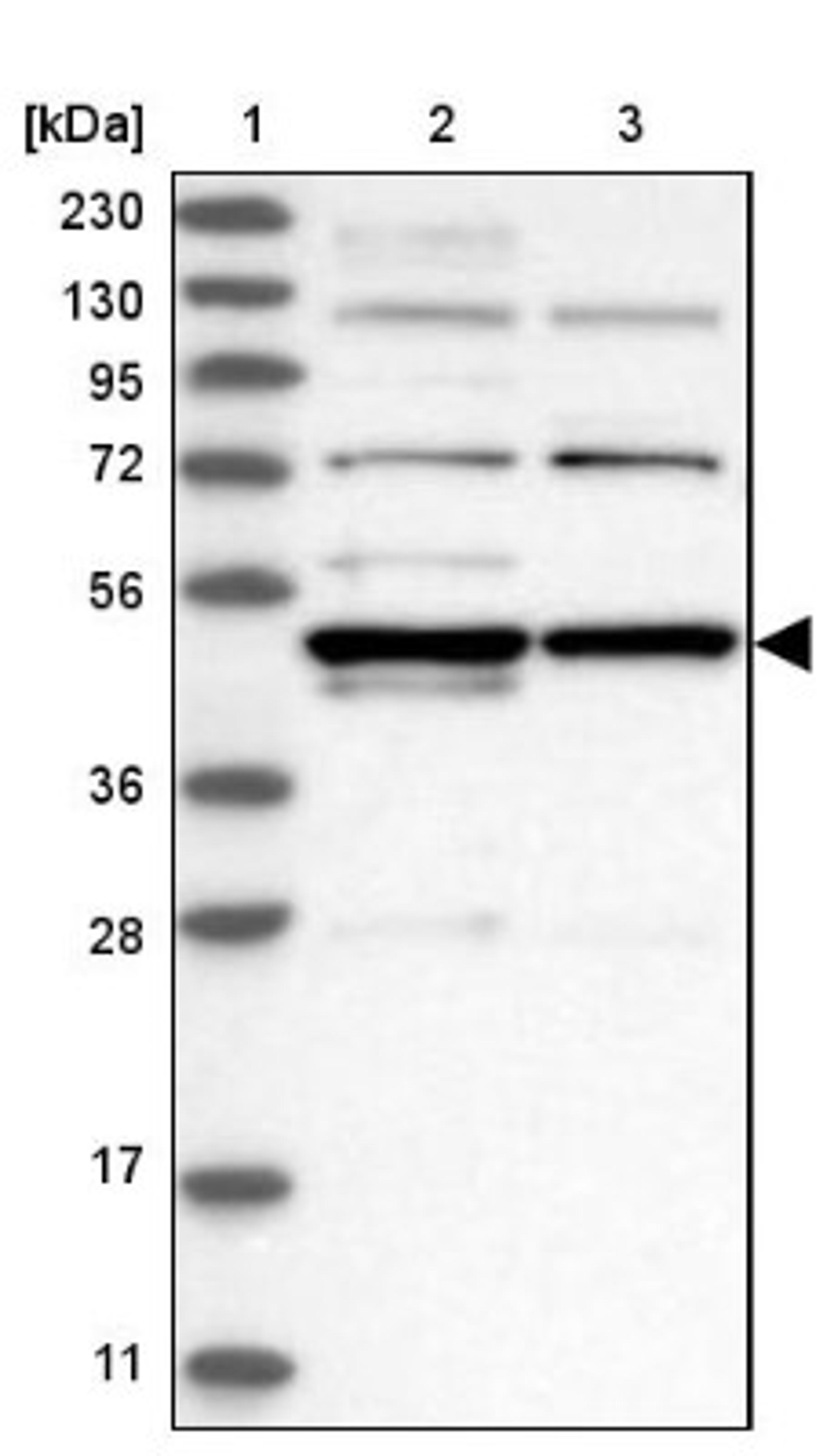 Western Blot: LYAR Antibody [NBP1-86827] - Lane 1: Marker [kDa] 230, 130, 95, 72, 56, 36, 28, 17, 11<br/>Lane 2: Human cell line RT-4<br/>Lane 3: Human cell line U-251MG sp