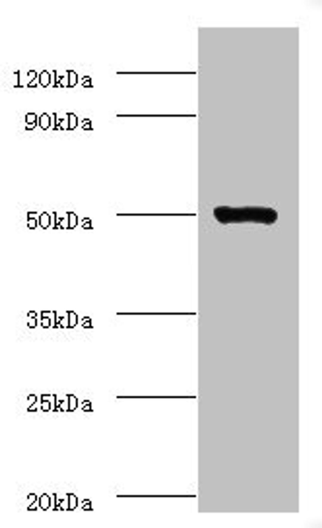 Western blot. All lanes: ACTL7A antibody at 2µg/ml + Mouse liver tissue. Secondary. Goat polyclonal to rabbit IgG at 1/10000 dilution. Predicted band size: 49 kDa. Observed band size: 49 kDa