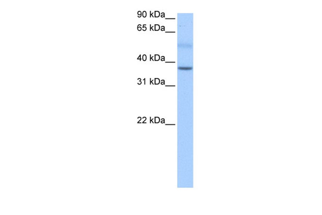 Antibody used in WB on Human Liver at 0.2-1 ug/ml.